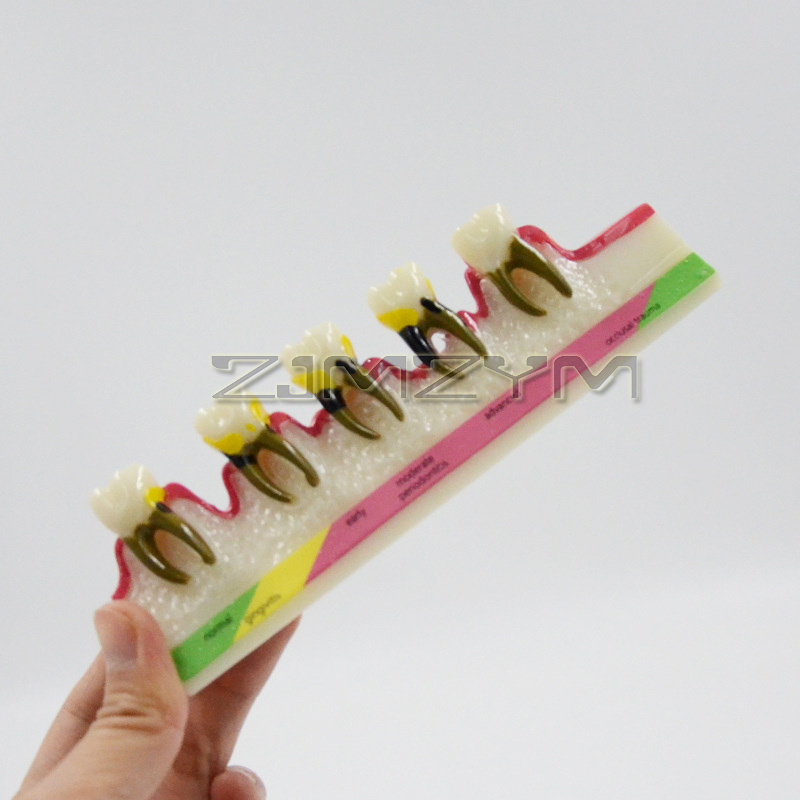 โมเดลโรคปริทันต์วัสดุทันตกรรมฟ - Medical Lab Study บทวิจารณ์และราคา
