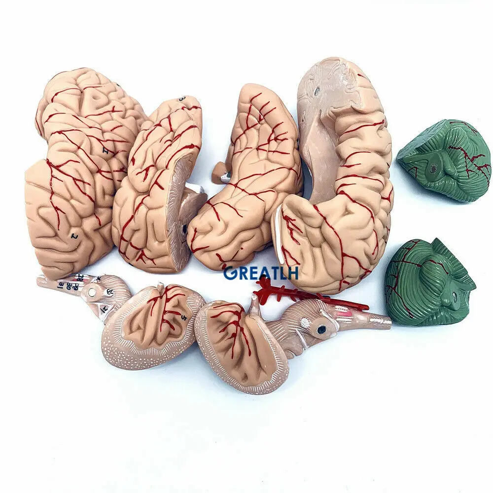 Greatlh โมเดลสมองกายวิภาคโมเดล - Medical Lab Study บทวิจารณ์และราคา